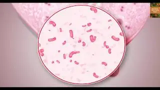Mastitis Treatment in Cow/Buffalo/Cattle/Goat|Vetnry&Organic Treatment for Mastitis|Agriculture|6/10