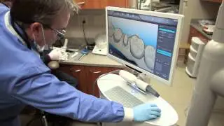 iTero Scanner and Dental Crown Benefits