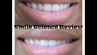SmileSciences Sweet-Teeth Whitening Kit Demo
