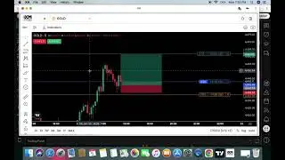 Risk Management Explained in 2 Minutes | Forex Bangla
