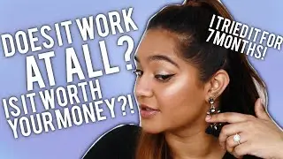 IS IT WORTH YOUR MONEY?! My Facial Laser Hair Removal experience at SUPERSMOOTH!