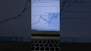 Investment Pick 