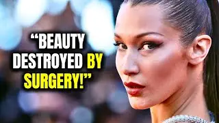 Top 10 SuperModels Plastic Surgery Disaster!