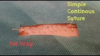 Simple Continuous Suture. Continuous Patterns