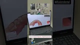 3D Scanning for Aligners #smiledesigndental #dentalclinic #dental #dentaloffice