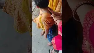 #Wryneck/Torticolis child patient treatment #@physiotherapy with Dr. Vandana #@