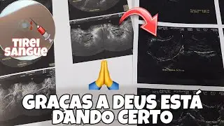 VIDA DE TENTANTE - FIZ A ULTRASSOM TRANSVAGINAL E VI A QUANTIDADE DE FOLÍCULOS + EXAME DE HORMÔNIOS