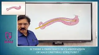 What is missing in the Classification of Urethral Stricture