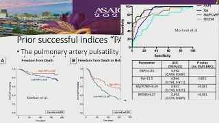 ASAIO 2025 | Aortic Pulsatility Index Predicts Post VA-ECMO Survival