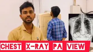 Chest PA view |chest x ray pa view #viral  #shortvideo #shortsvideo #sehar @AzhaR-live-5.2k-view 