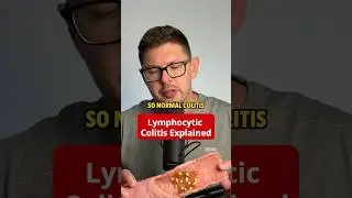 Lymphocytic Colitis Explained Simply