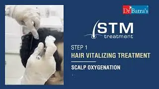 Shocking Hair Regrowth in 10 Weeks! Experience Dr Batra's STM Cell Treatment 💇&zwj;♂️