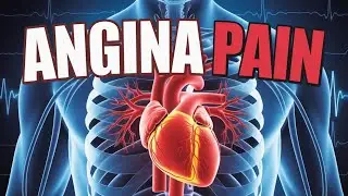 What is Angina Pectoris? Causes, signs and symptoms, Diagnosis and treatment.