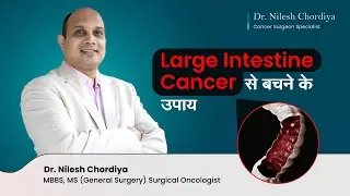 Large Intestine Cancer से बचने के उपाय | Tips to Avoid Colon Cancer | Dr  Nilesh Chordiya