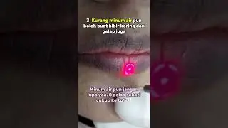 Punca bibir gelap dan solusinya! #klinikprimernilampuri #drlynaestetikklinikkelantan #lcpholder