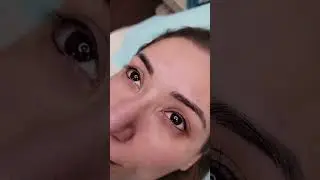 Eyelash Enhancement
