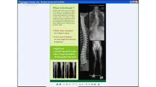SCANOGRAM