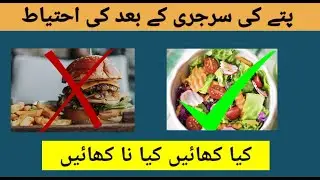 Diet after gall bladder surgery | Gallbladder food | Diet after laparoscopic cholecystectomy