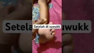 #beranda #foryou #pengobatan #masukberanda #youtubeshorts #ytshorts #kiamintherapy #reelsvideo #yt