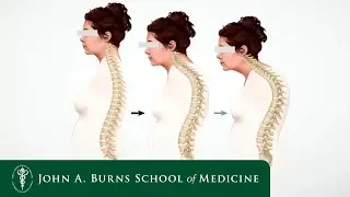 Spine Augmentation and Vertebral Compression Fractures by Ferdinand Hui, MD. (Spring 2023)