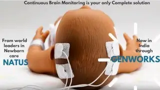 GENWORKS completes the New Born Care with NATUS Brain Monitoring