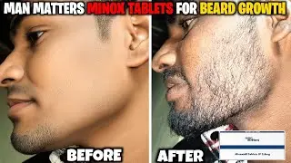 Man matters minoxidil tablets की सच्चाई | minoxidil beard growth | minoxidil beard | side effects