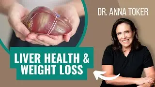 Why Liver Health Is Important to Weight Loss