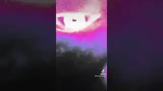 Moving eye. (Don&rsquo;t watch if you have epilepsy)
