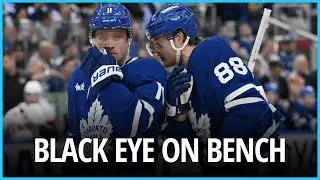 Leafs Coach Craig Berube Injured in Gym Accident  Marner Returns। USA NEWS TODAY