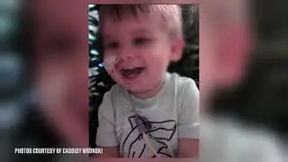 Это Алабама: замена назогастрального зонда в домашних условиях.