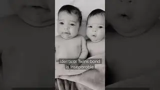 Twins bond is inseparable #twins #stormi #shorts #babyshorts #babies #love #hearttouching