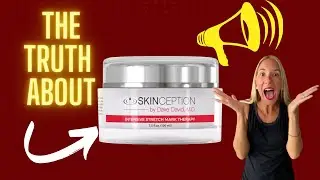 THE TRUTH Skinception Intensive Stretch Mark Therapy Review&ndash;Bye bye Stretch Marks