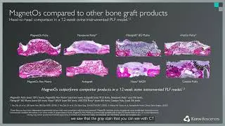 How does MagnetOs compare to other commercially available bone grafts on the market?