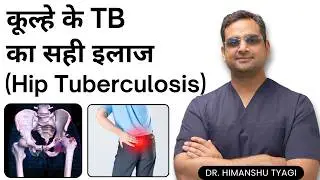 कूल्हे के TB का सही इलाज | Hip Tuberculosis | कूल्हे के जोड़ की टीबी – लक्षण, जांच और इलाज