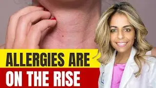 Why So Many Kids Have Allergies, Asthma & Eczema | Expert Explains