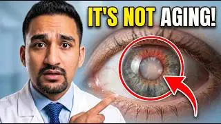 मोतियाबिंद क्या है? Cataract Explained Simply | Dr Saurabh Deshmukh | Eye Specialist Bhopal