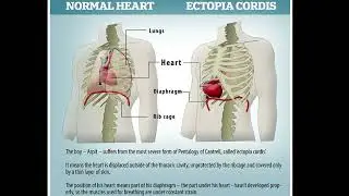 Lymphatic system