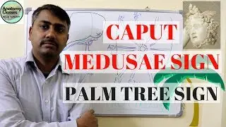 Caput Medusae
