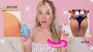 The TRUTH About How I Fixed My Butt Acne | My Experience With Truly Beauty's Berry Cheeky Products