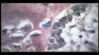 Learning Bone Growth 2: The Osteoblast and Woven Bone Formation