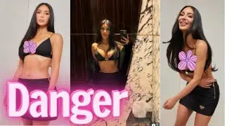 Kim Kardashian causes concern with her too thin body as her health seriously declines
