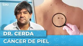 🔎 C&Aacute;NCER DE PIEL: Una de las enfermedades onc&oacute;logicas m&aacute;s frecuentes | El Destape Salud