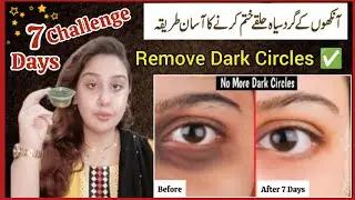 DIY Coffee Oil For Dark Circles✅ Remove Dark Circles In Just 7 Days Challenge✨ Madiha Kiran