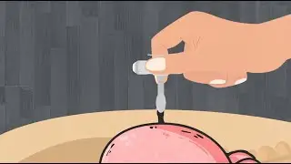 G-Tube - Managing Situations When the G-Tube Comes Out - Stanford Medicine Children's Health