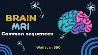 Basic MRI  sequences II Brain MRI sequences