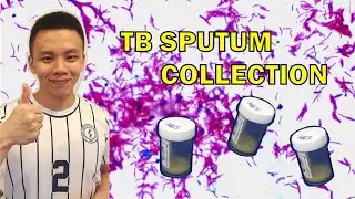How to do a proper sputum collection!