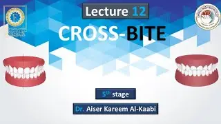 Crossbite Lec.12 stage5