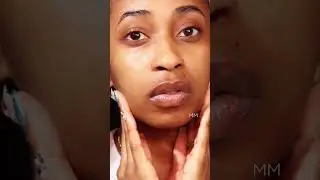 BEST RETINOL FOR HYPERPIGMENTATION? SHANI DARDEN RETINOL | MILLENNIALMUZE