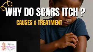 Why Do Wounds Itch?