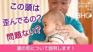 ウチの子の頭って歪んでる？頭の形について説明します！ #赤ちゃんの頭の形